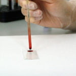 11_Coronavirus_01